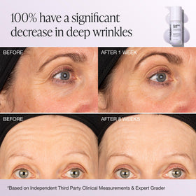 INNBEAUTY Project styled before-and-after sample suggesting improved elasticity benefit