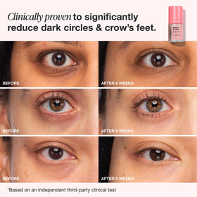 Innbeauty Project before and after comparison demonstrating visible brightening