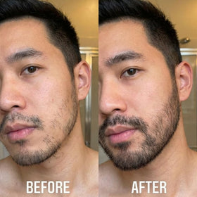 Innerbloom formula drop on skin showing texture and quick absorption benefit