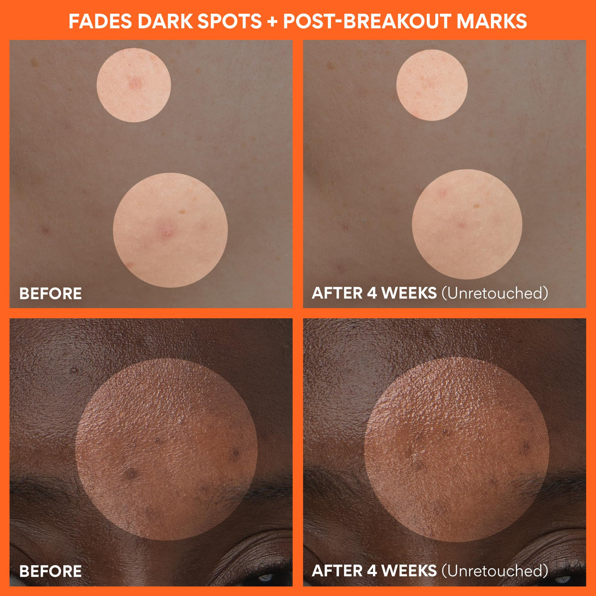 innisfree applying cream to cheek for evening skin tone benefit