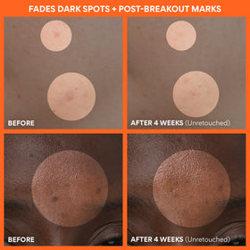 innisfree applying cream to cheek for evening skin tone benefit