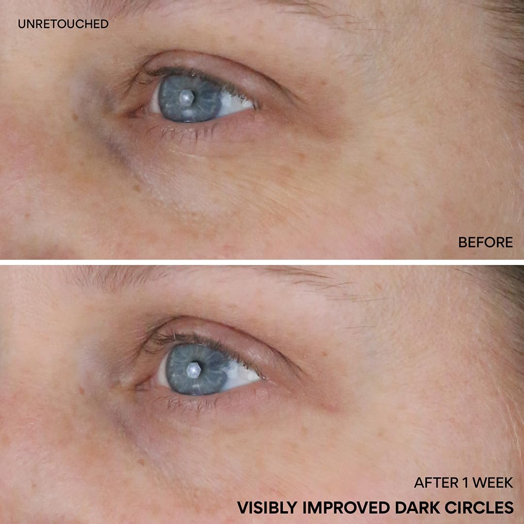 innisfree applying roll-on to under eye demonstrating circulation boost benefit