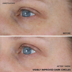 innisfree applying roll-on to under eye demonstrating circulation boost benefit