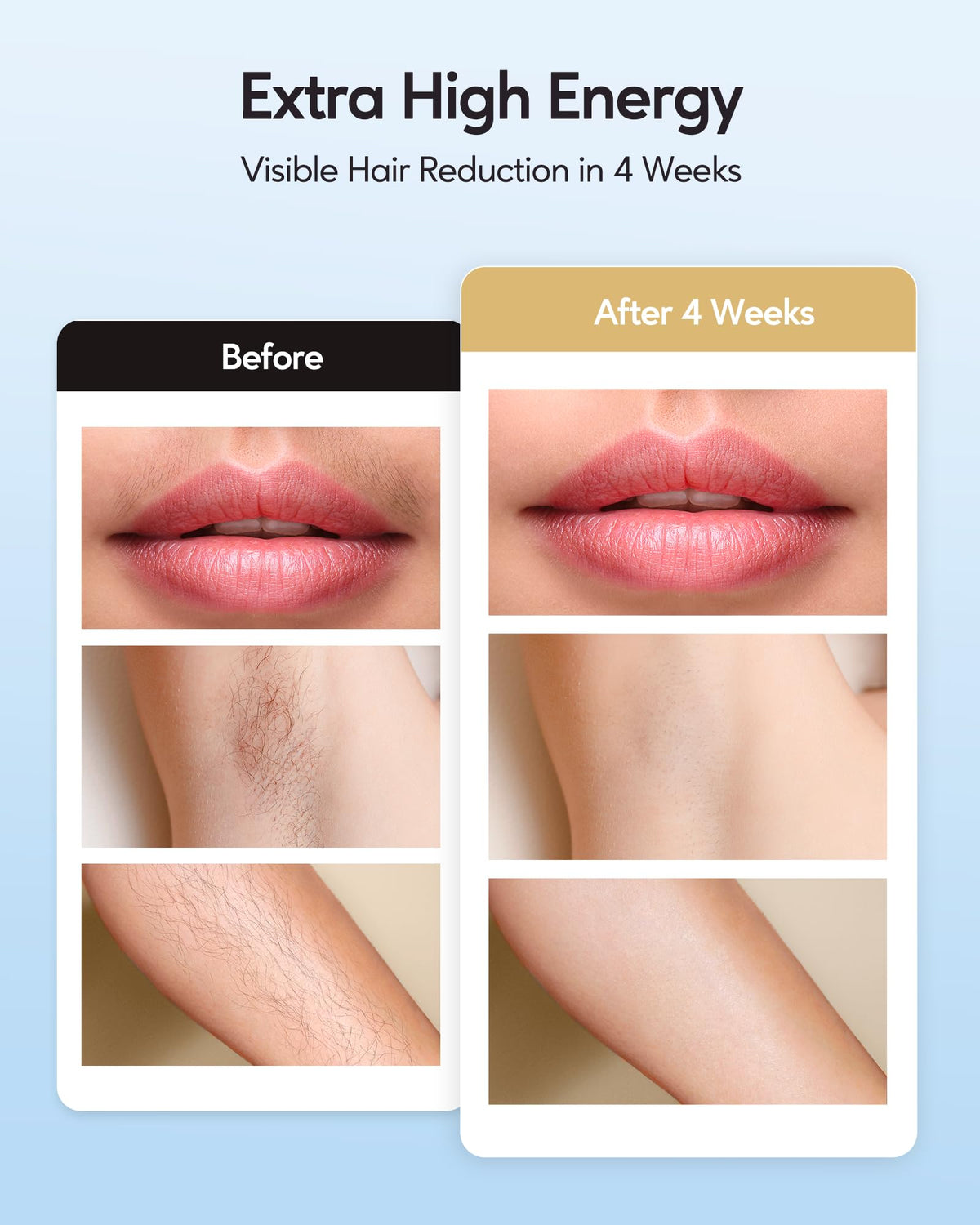 INNZA device in use on leg demonstrating smooth hair reduction