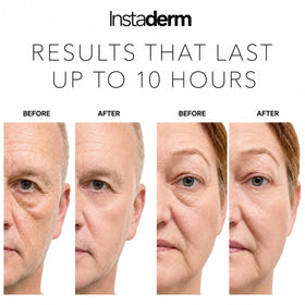 Instaderm before and after comparison showing reduced puffiness