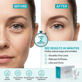 Instantly Ageless open box displaying 25 vials for easy portability