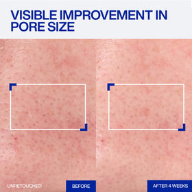 IOPE serum texture close-up showing lightweight blend for smooth application