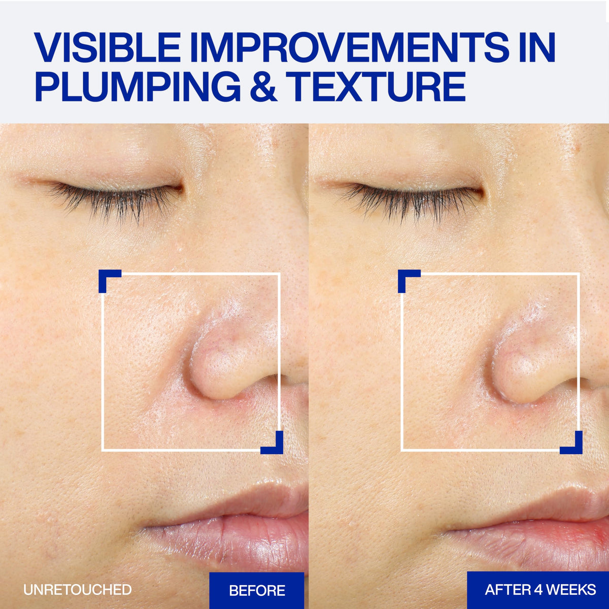 IOPE droplet on skin showing hydration and instant plumping benefit