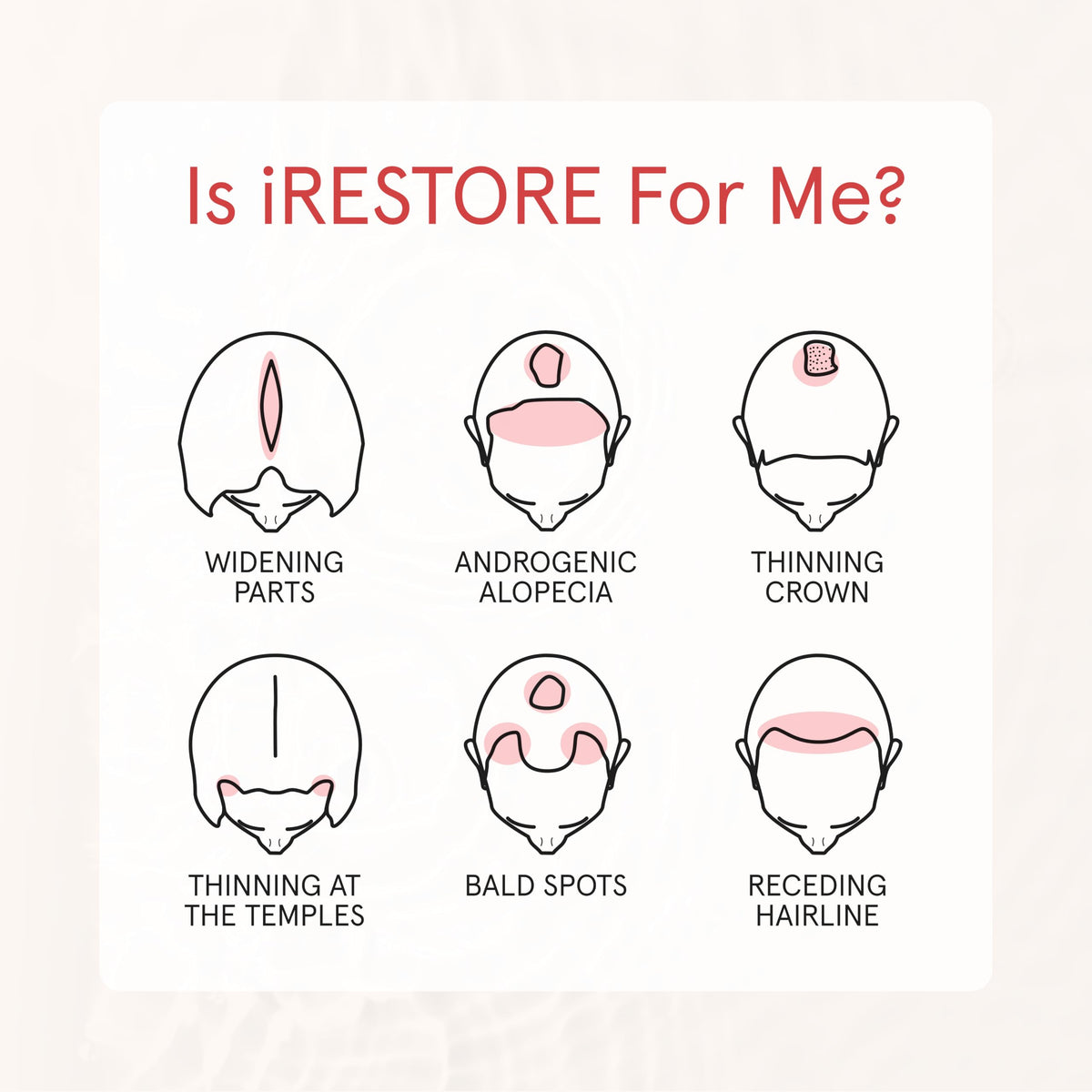 iRestore before and after hair comparison showing fuller-looking results