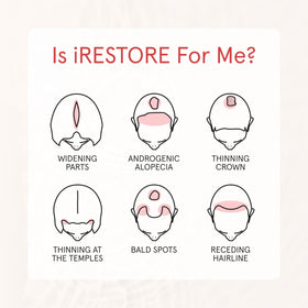 iRestore before and after hair comparison showing fuller-looking results