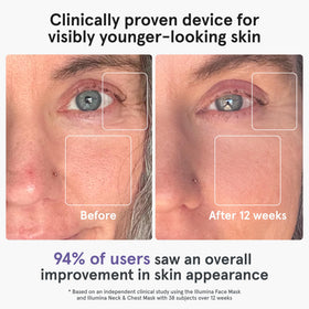 iRestore close-up of LED array highlighting triple-wavelength therapy benefits