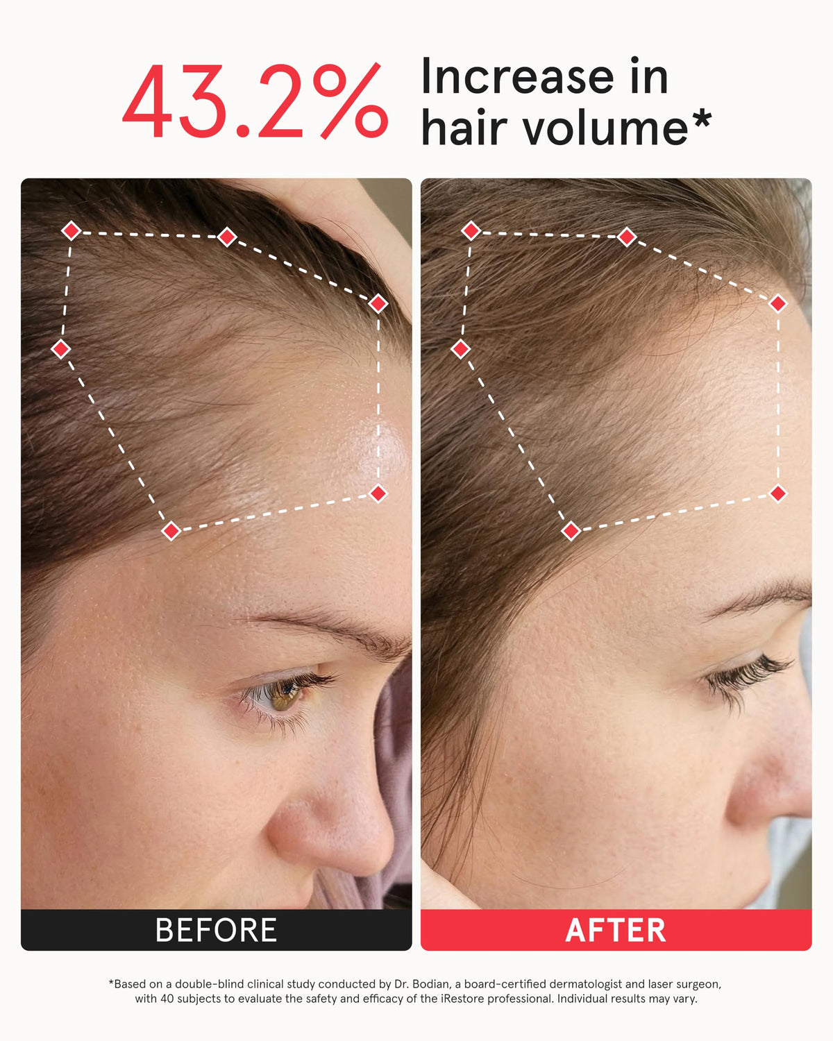 iRestore worn on head demonstrating hands-free relaxation benefit