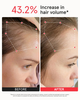 iRestore worn on head demonstrating hands-free relaxation benefit