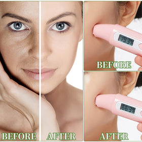 IREV mask applied on face demonstrating fast soothing effect