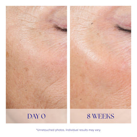 iS CLINICAL product applied to hand demonstrating ease of use and quick action