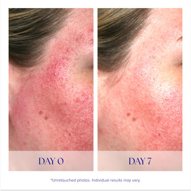 iS CLINICAL label close-up highlighting key ingredients and clarity benefit