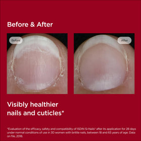 ISDIN Si-Nails beside coin showing 0.08 fl oz travel-friendly size