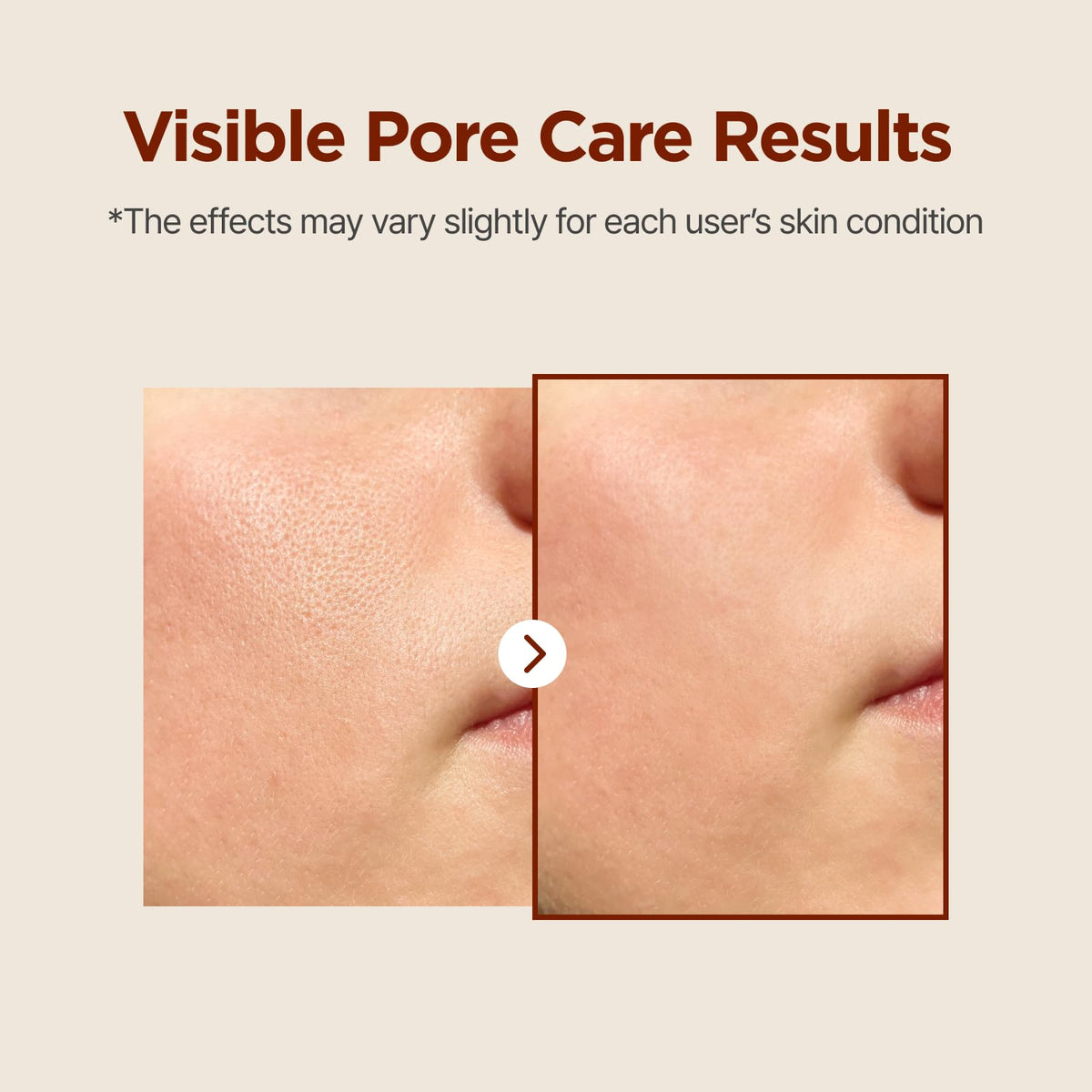 ISNTREE watery toner texture poured, demonstrates fast absorption and light feel