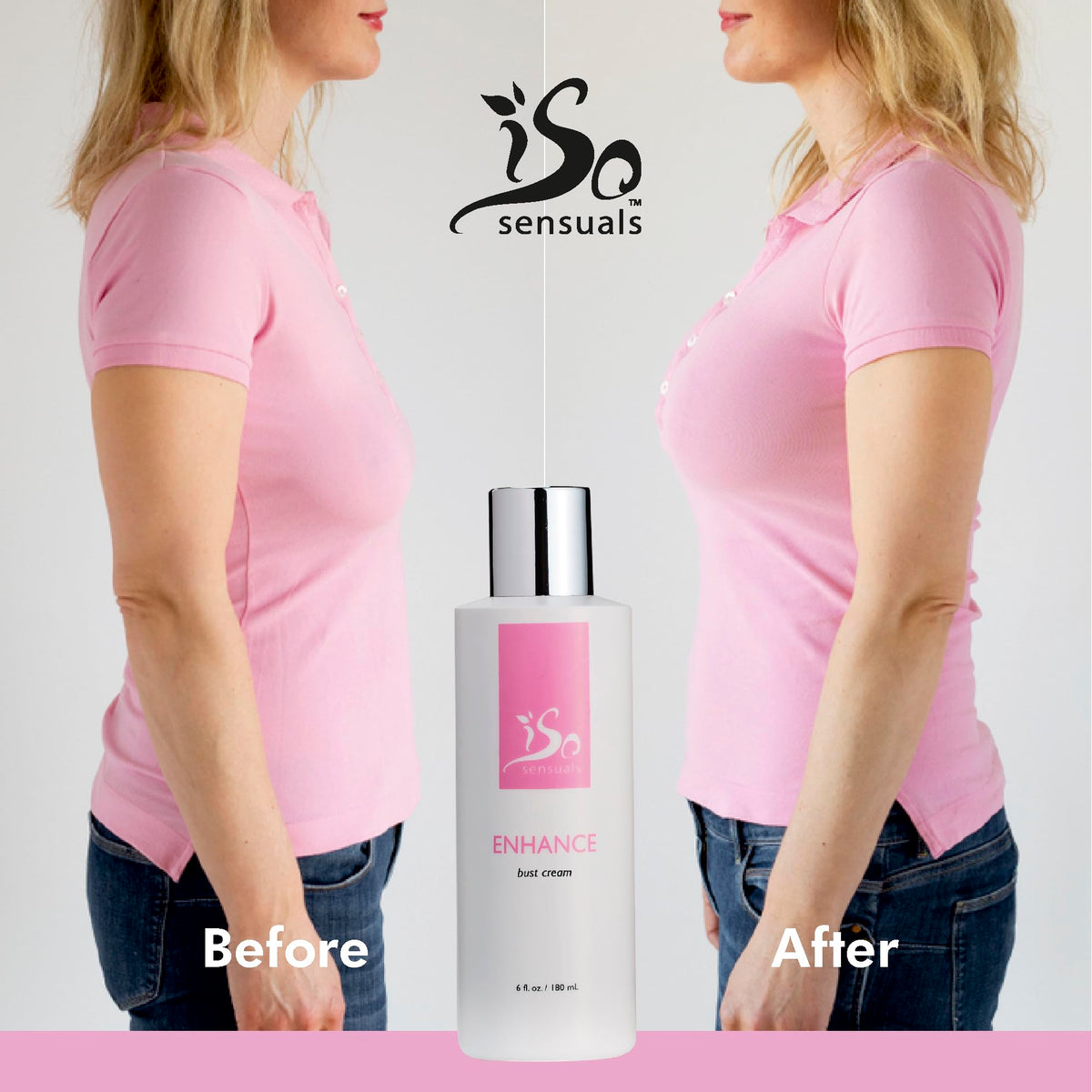 Before and after diagram with IsoSensuals showing improved contour and fuller appearance