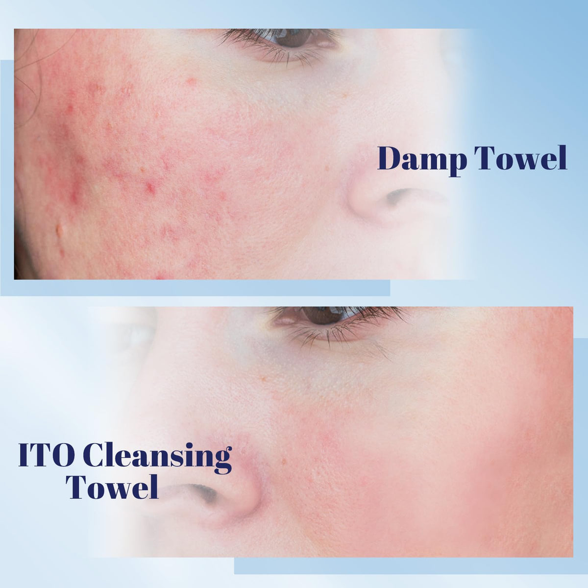 ITO CORPORATION towel removing makeup gently around the eyes for comfort