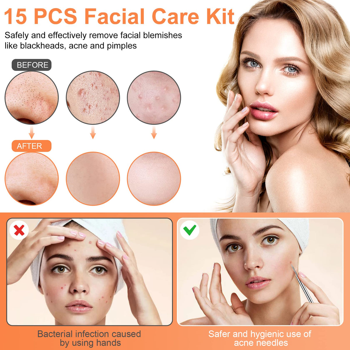 IUMAKEVP varied loop ends demonstrating sizes for different pore types
