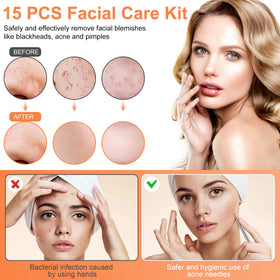 IUMAKEVP varied loop ends demonstrating sizes for different pore types