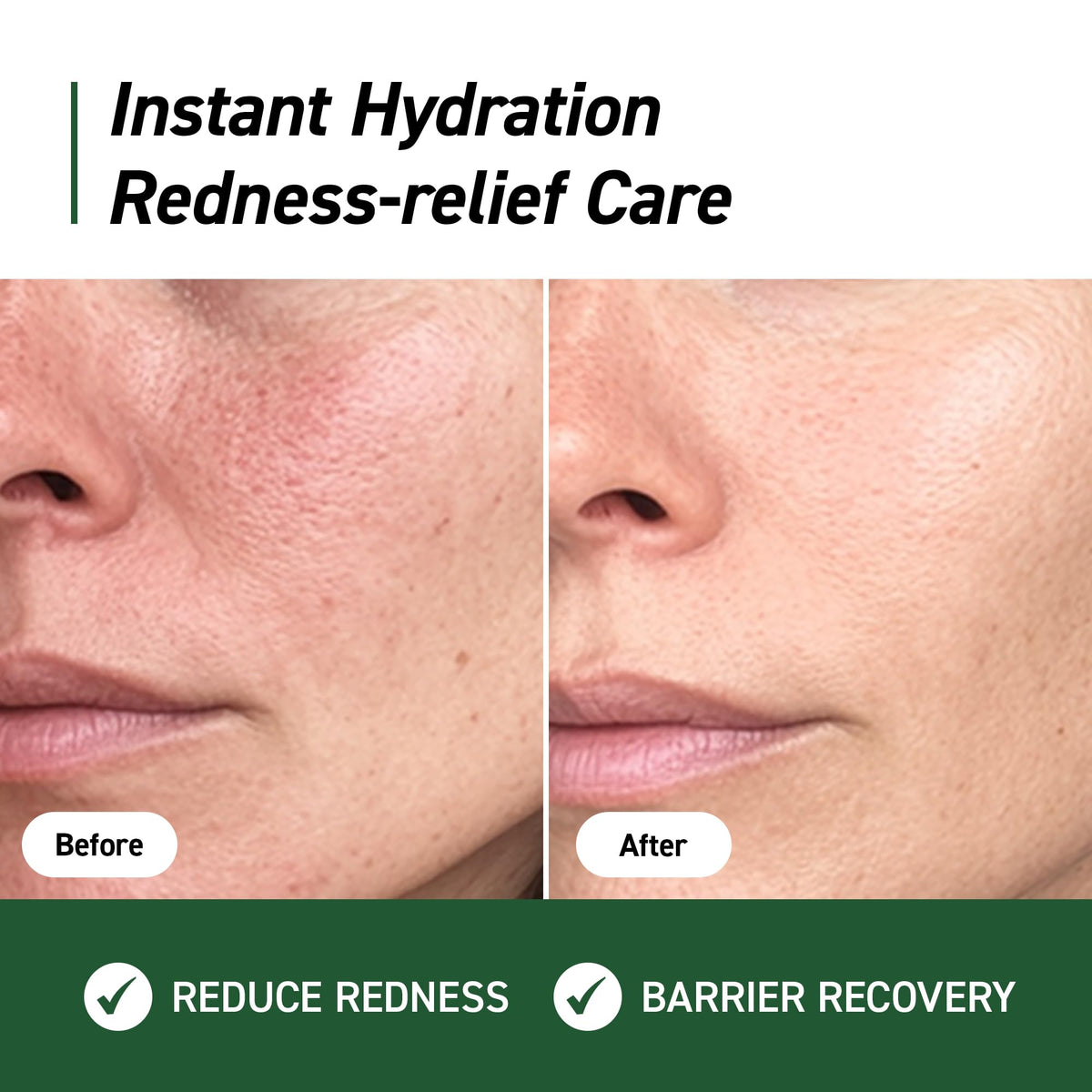 IVOSKIN cream texture close-up highlighting lightweight hydrating finish benefit