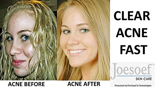 JOESOEF SKIN CARE lather on skin demonstrating rich foam for effective cleansing