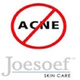 JOESOEF before and after illustration showing clearer looking complexion support