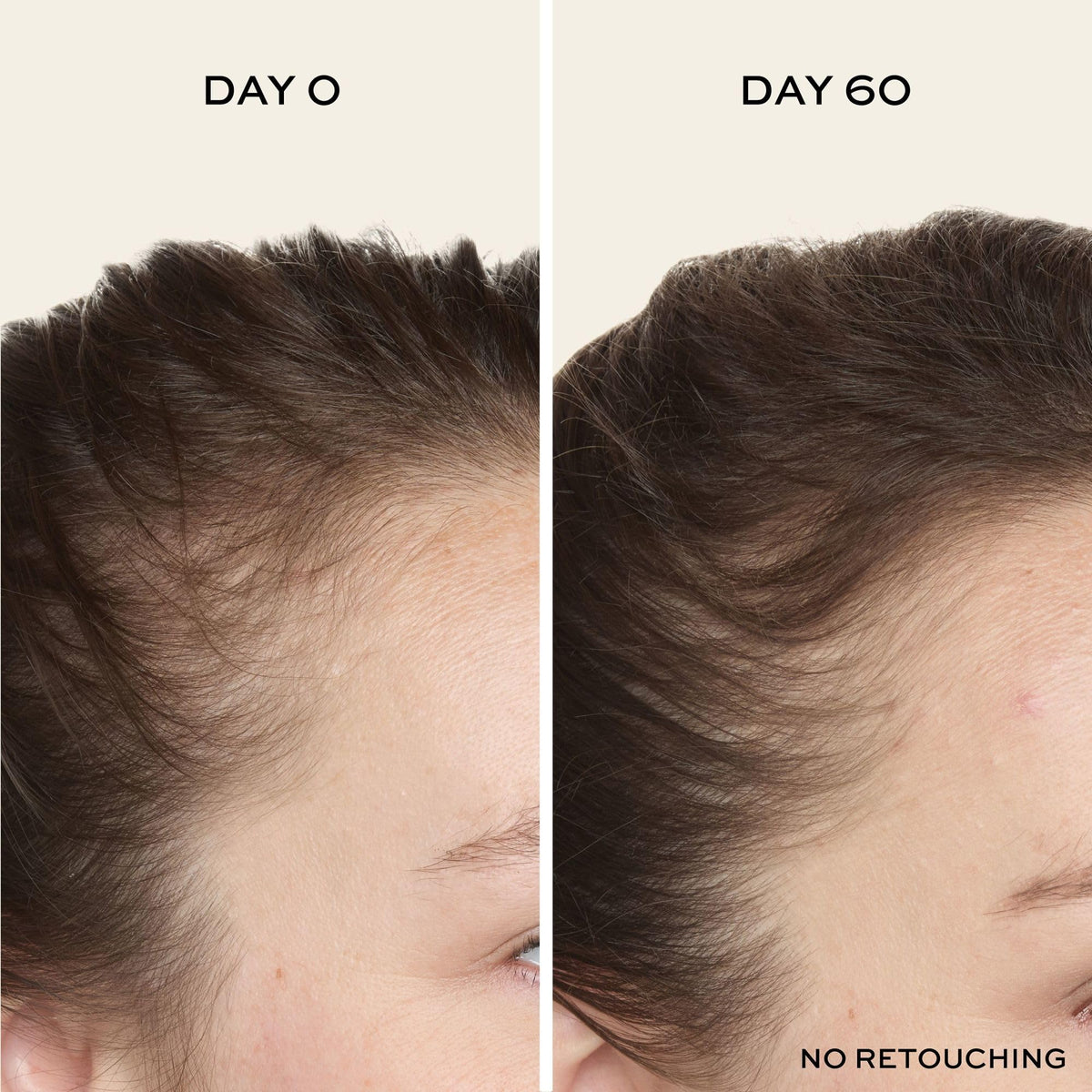 John Frieda applying serum to scalp with fingertips to boost root coverage benefit