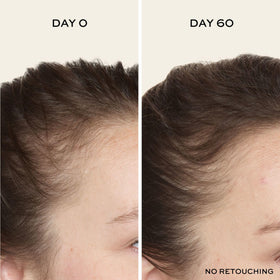 John Frieda applying serum to scalp with fingertips to boost root coverage benefit