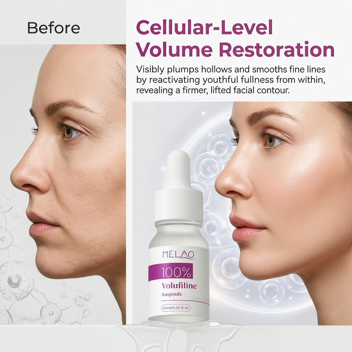 Jornanbo applied to cheek showing targeted volume enhancement