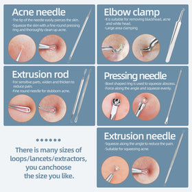 JPNK close detail of angled lancet tip designed for precise whitehead release and targeted care