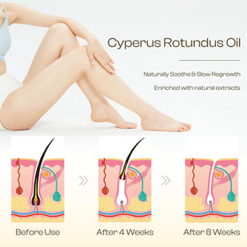 Jtopyrt applied to underarm to reduce regrowth and calm skin