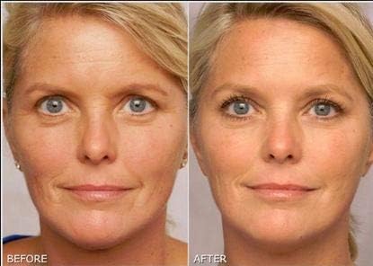 K6 Skin Care gel staged in bathroom setting suggesting nightly skincare routine use