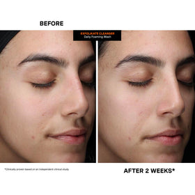 Kate Somerville before and after skin texture comparison showing refined appearance