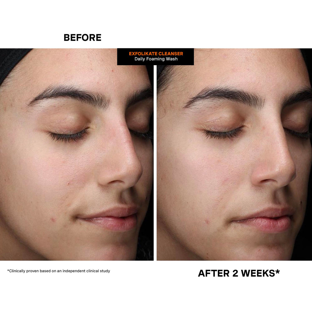 Kate Somerville clinic-to-cabinet display conveying professional formulation