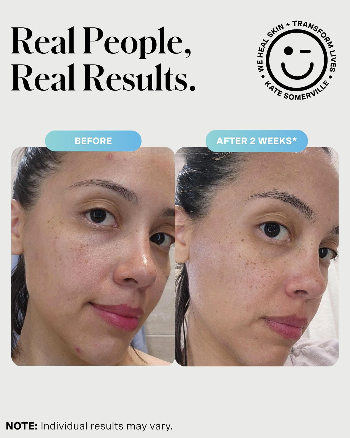 Kate Somerville used as a short-contact sulfur mask on breakout area to target blemishes benefit