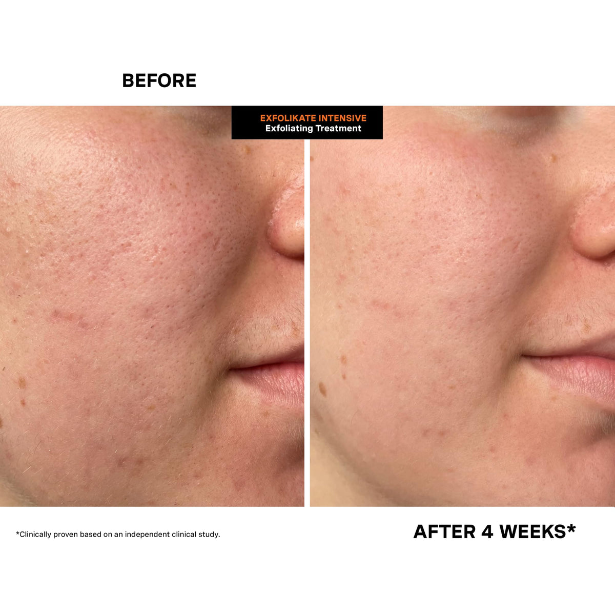 Kate Somerville dispensing product demonstrating easy application