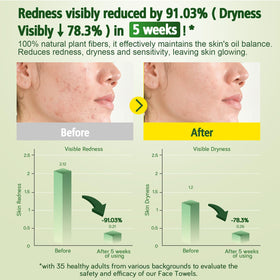 KeeiZoes smooth side close detail for gentle sensitive-skin care