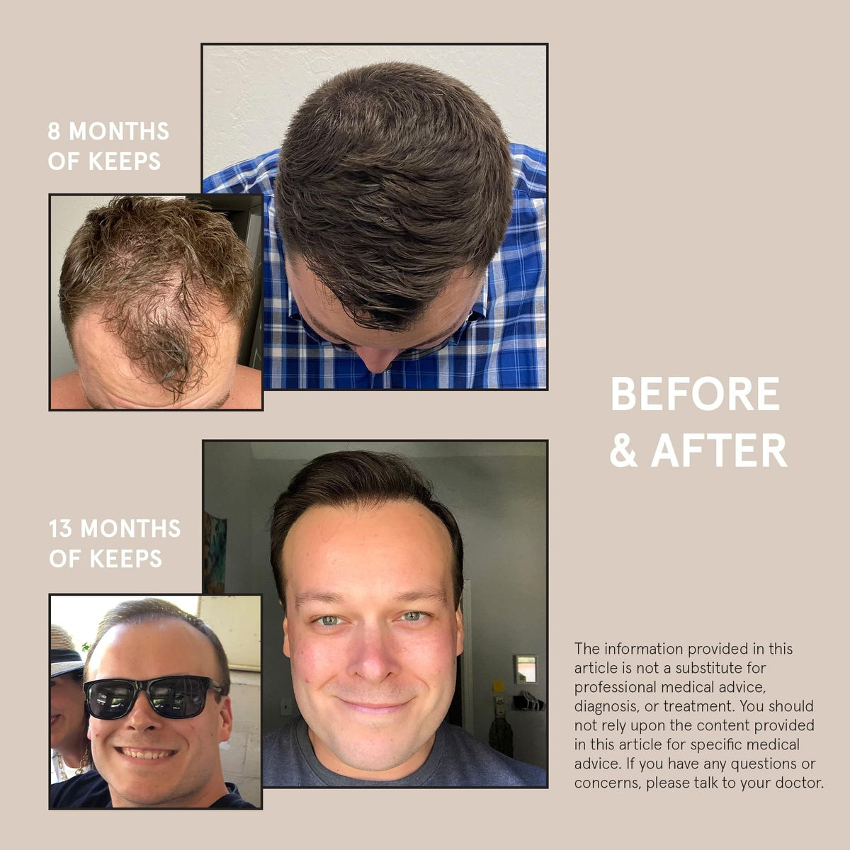 Keeps conditioner next to a hair treatment kit indicating compatibility with hair-loss routines