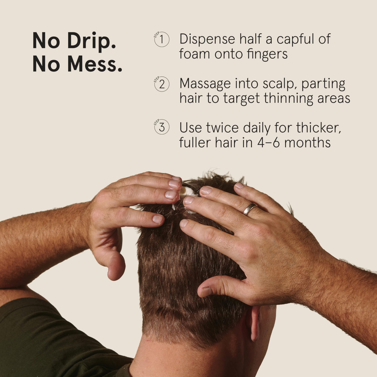 Keeps foam being applied to crown demonstrating targeted scalp coverage benefit
