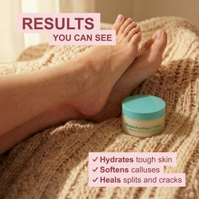 Kerasal open jar with visible cream indicating easy scoop and use