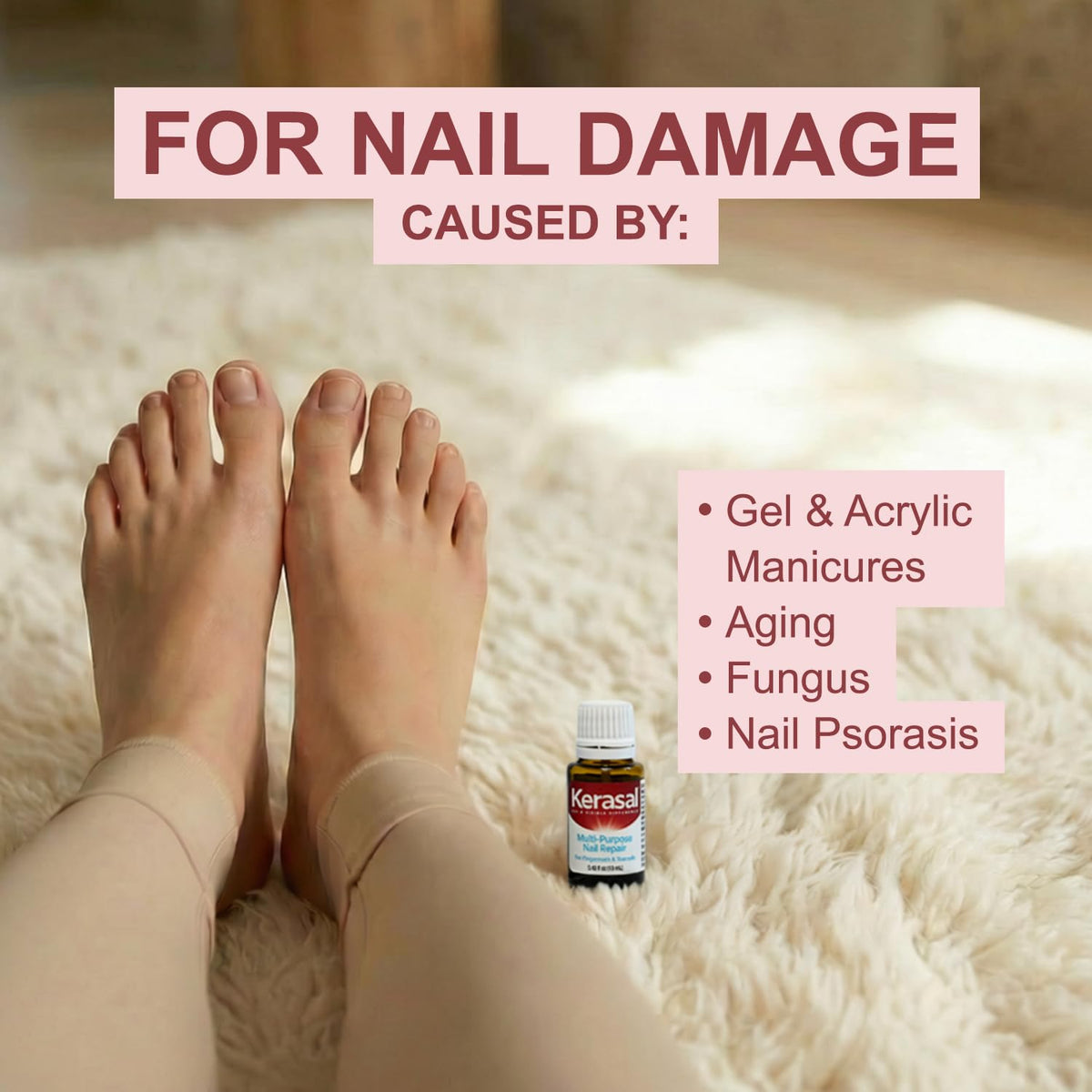 Side-by-side nail before and after images illustrating Kerasal visible appearance improvement