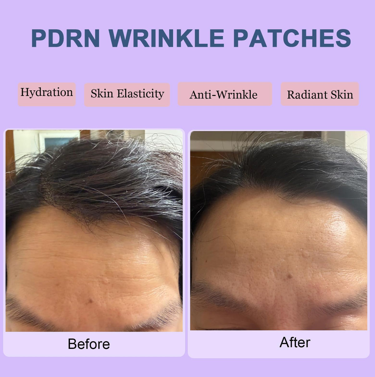 Kewhunt forehead patch applied during sleep demonstrating secure overnight wear