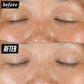 Kiehl's Activated C ingredient visual showing targeted brightening benefit