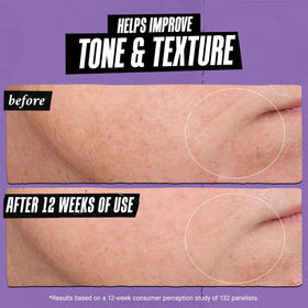 Before and after skin texture comparison with Kiehl's clarifying effects