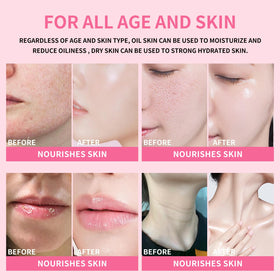 KIMUSE product used around eye and neck showing gentle application and targeted moisture