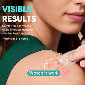 kindshine patch applied to forehead demonstrating discreet wear