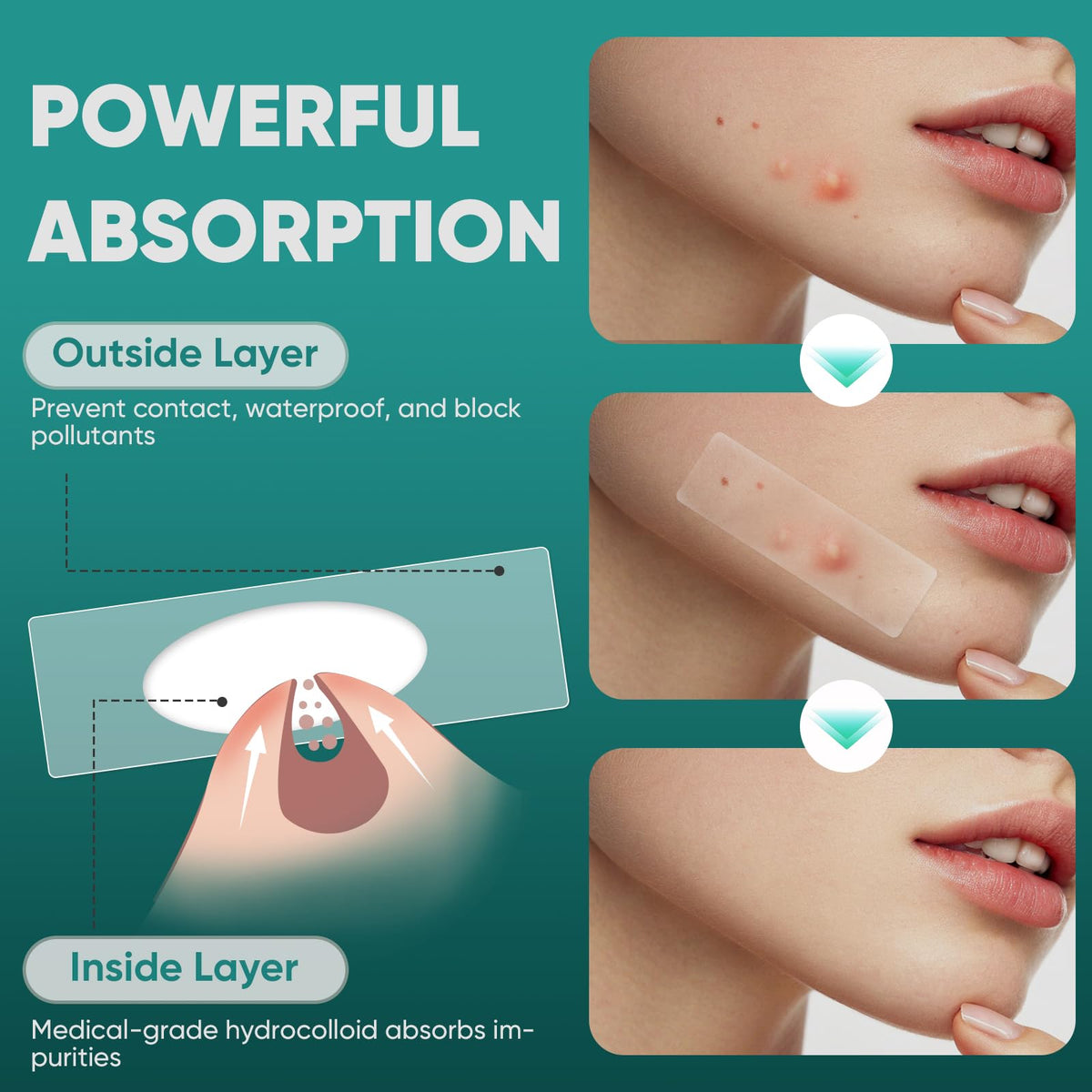 kindshine translucent edge detail illustrating secure adhesion and low profile